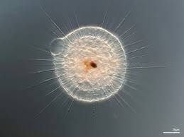 <p><span style="background-color: transparent;"><span>(kelp, brown algae, diatom, oomycetes) </span></span>Hairy flagella; diatoms, brown algae → <strong>“Straw on a broom”</strong>. </p>