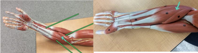 <p>Identify this muscle?</p>