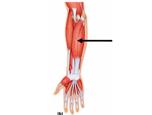 <p>Orgin: distal humerus, ulna and radius</p><p>insertions: middle phalanges of second fifth finger</p><p>functions: flexes wrist and finger</p>