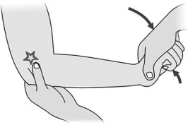 <ul><li><p>pos sign</p><ul><li><p>pain on LATERAL epi.</p></li></ul></li></ul>