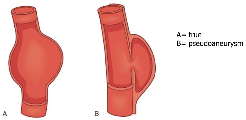 <p>lined by all 3 AO layer</p>