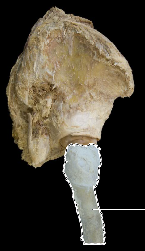 <p>hip joint</p>