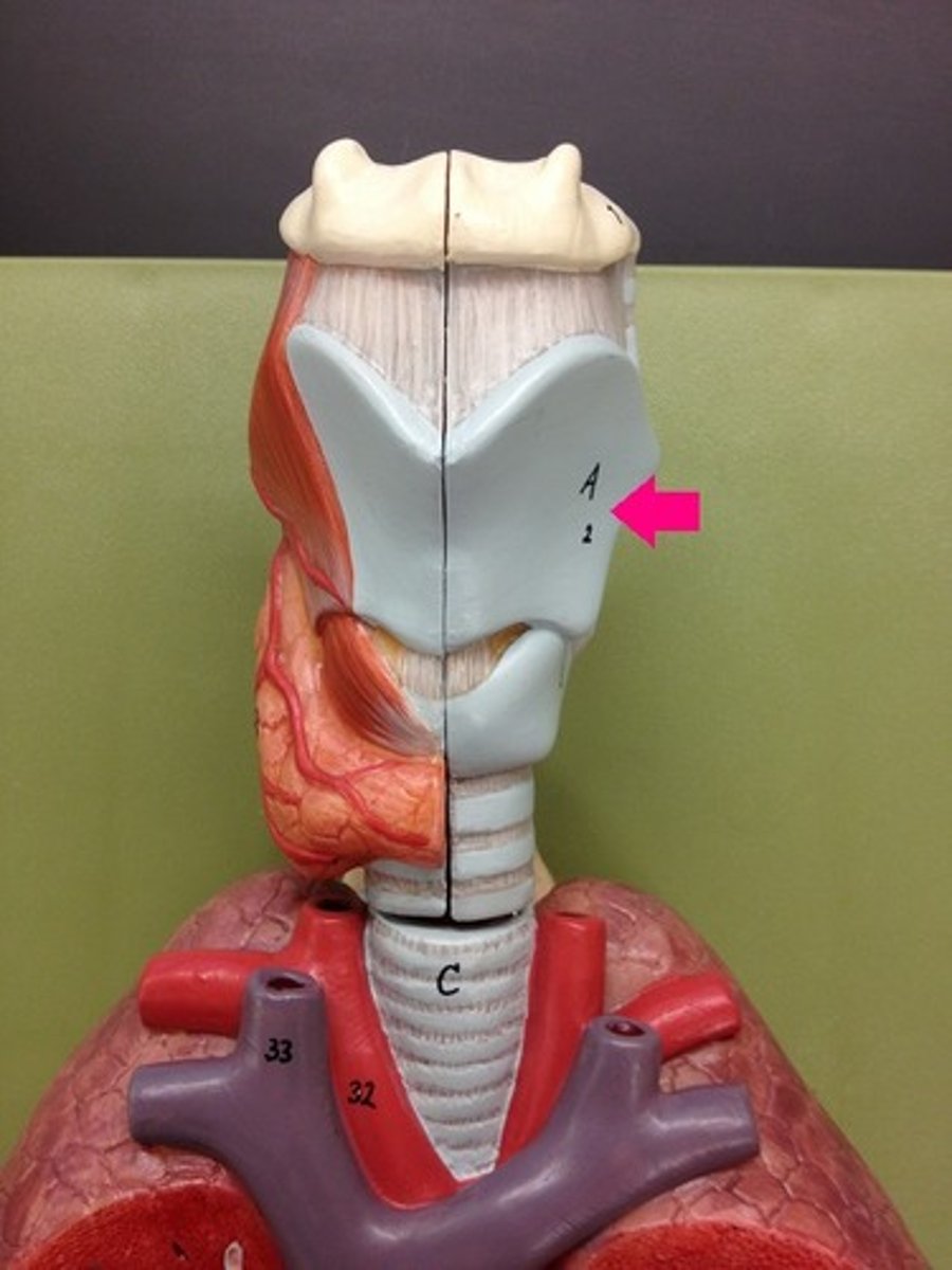 <p>Identify the structure.</p>