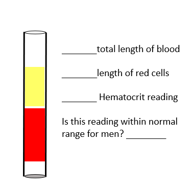 <p><strong>Total length of blood:</strong> Entire column of blood in the tube (red + yellow = 100%).</p><p><strong>Length of red cells:</strong> The red portion at the bottom of the tube, approximately <strong>60%</strong> of the total length.</p><p><strong>Hematocrit reading:</strong> <strong>60%</strong>.</p><p><strong>Is this reading within normal range for men?</strong> <span data-name="cross_mark" data-type="emoji">❌</span> <strong>No</strong>, the normal hematocrit range for men is about <strong>40–54%</strong>, so <strong>60% is above normal</strong> (which could indicate <strong>polycythemia</strong> or dehydration).</p>
