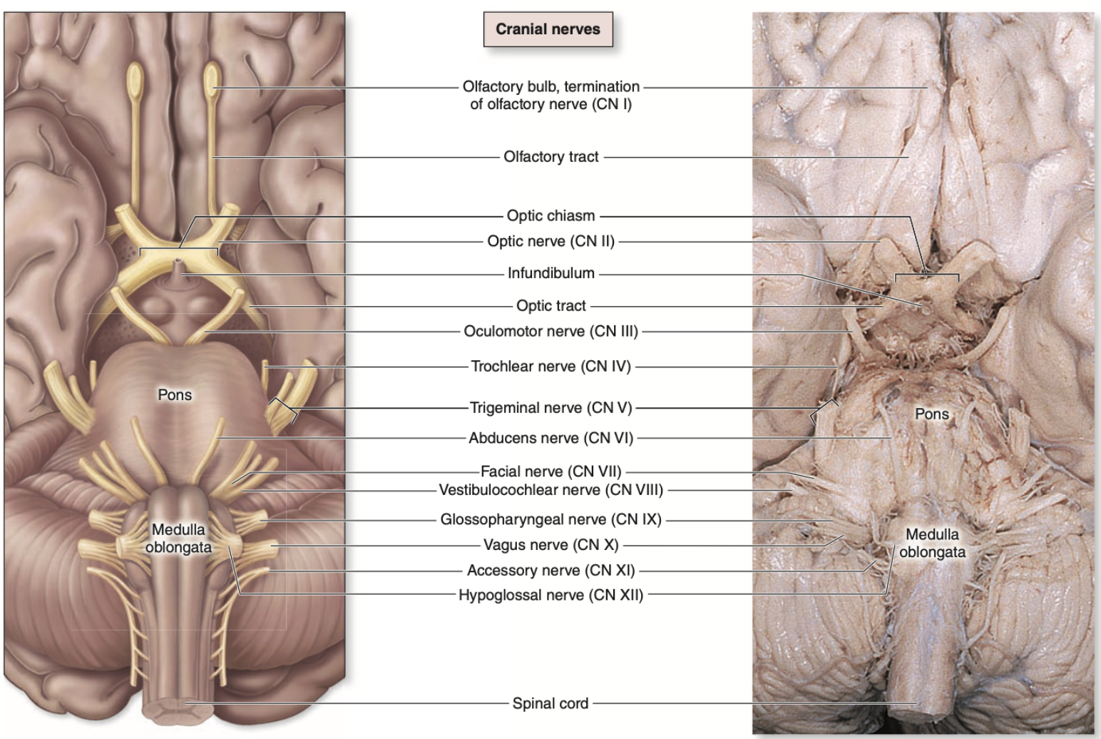 <p>Trigeminal IV</p>