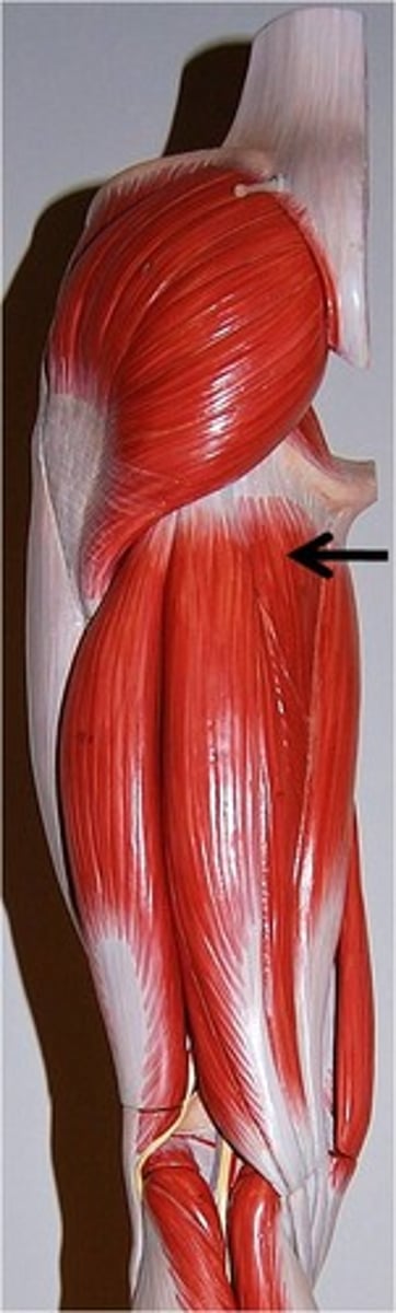 <p>Origin: Oblique head - inferior ramus of pubis &amp; ischial ramus, Vertical head - ischial tuberosity.<br>Insertion: Oblique head - gluteal tuberosity, linea aspera and proximal supracondylar line of femur, Vertical head - adductor tubercle of femur<br>Action: Adducts the femur at the hip, Flexes thigh</p>