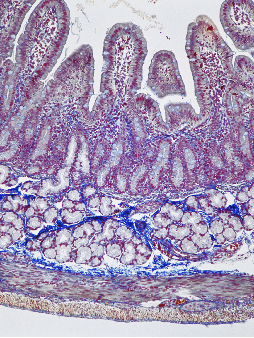 <p>List the layers in the small intestine</p>
