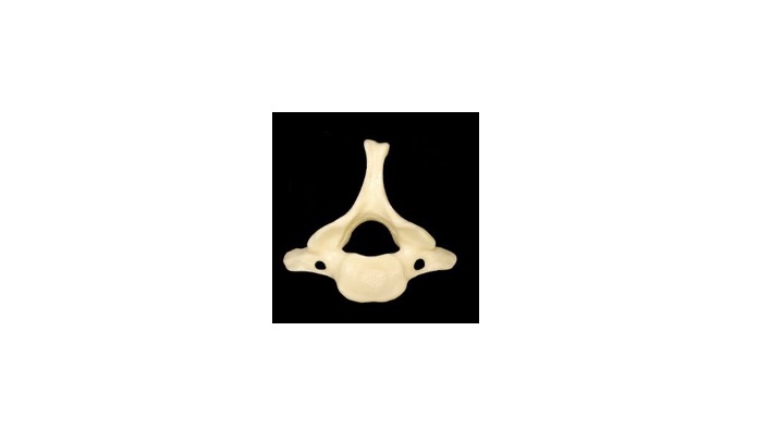 <p>What type of bone marking is this? (hint: it’s an opening)</p>