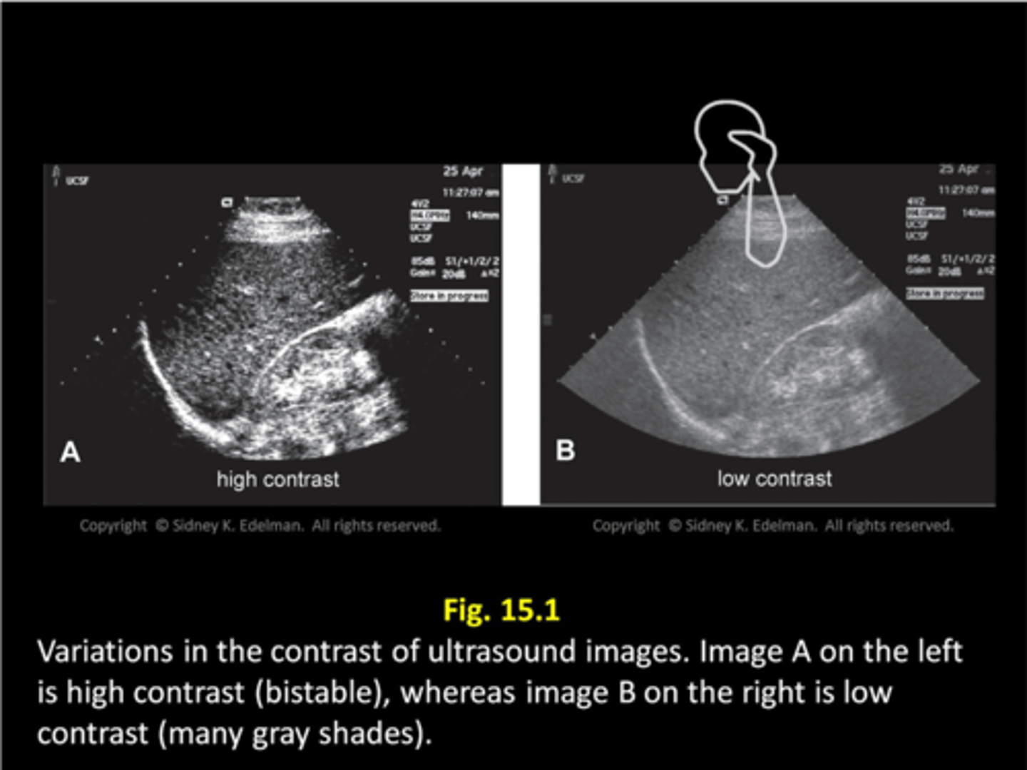 <p>the range of brilliancies (brightness) within the displayed image</p>
