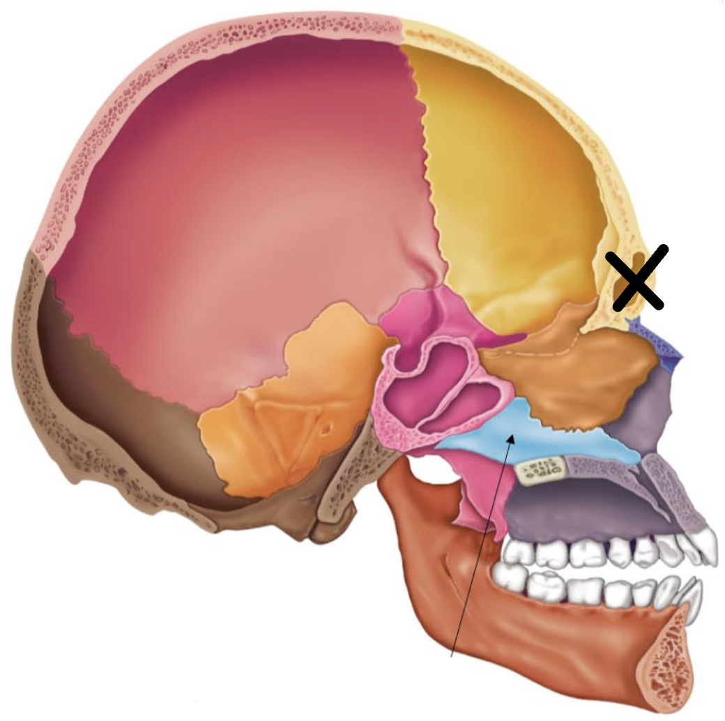 term image