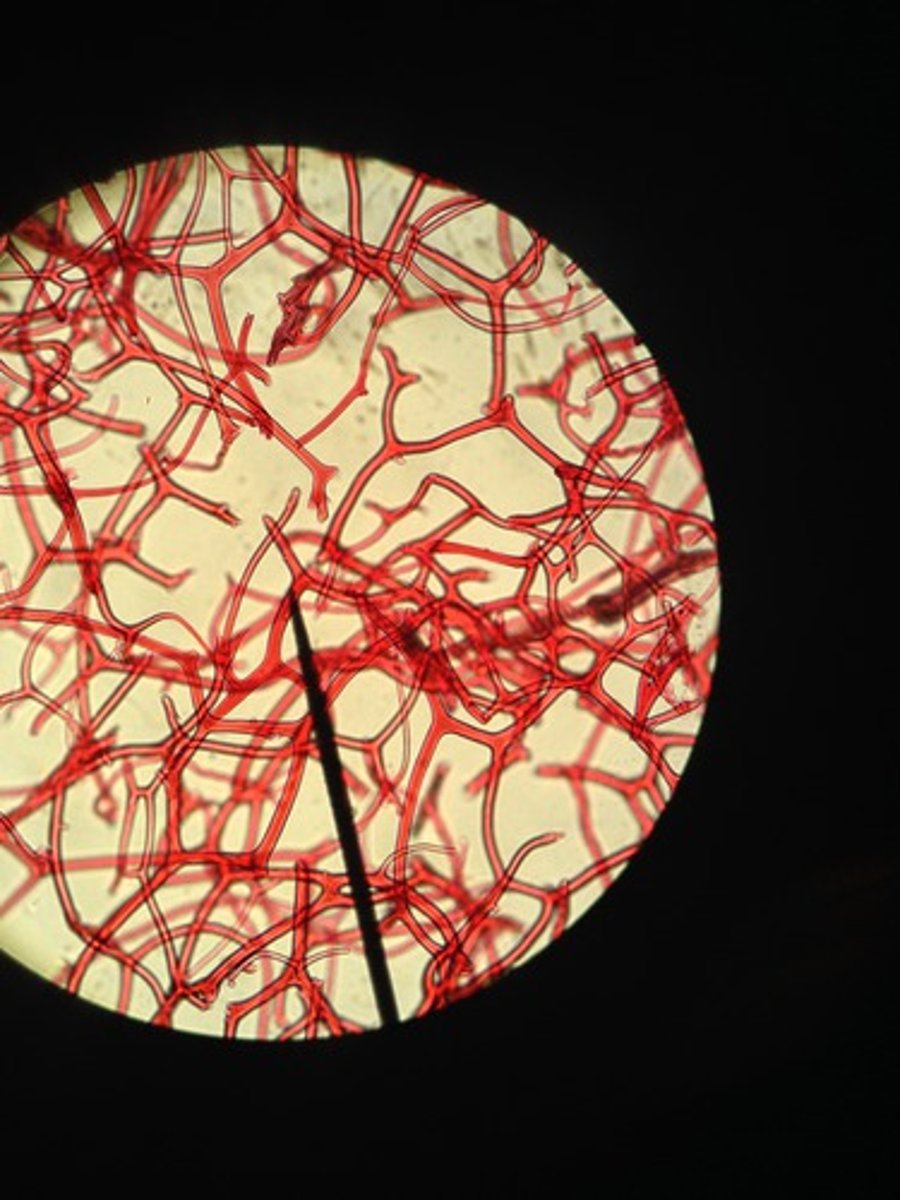 <p>What is this in the sponge?</p>