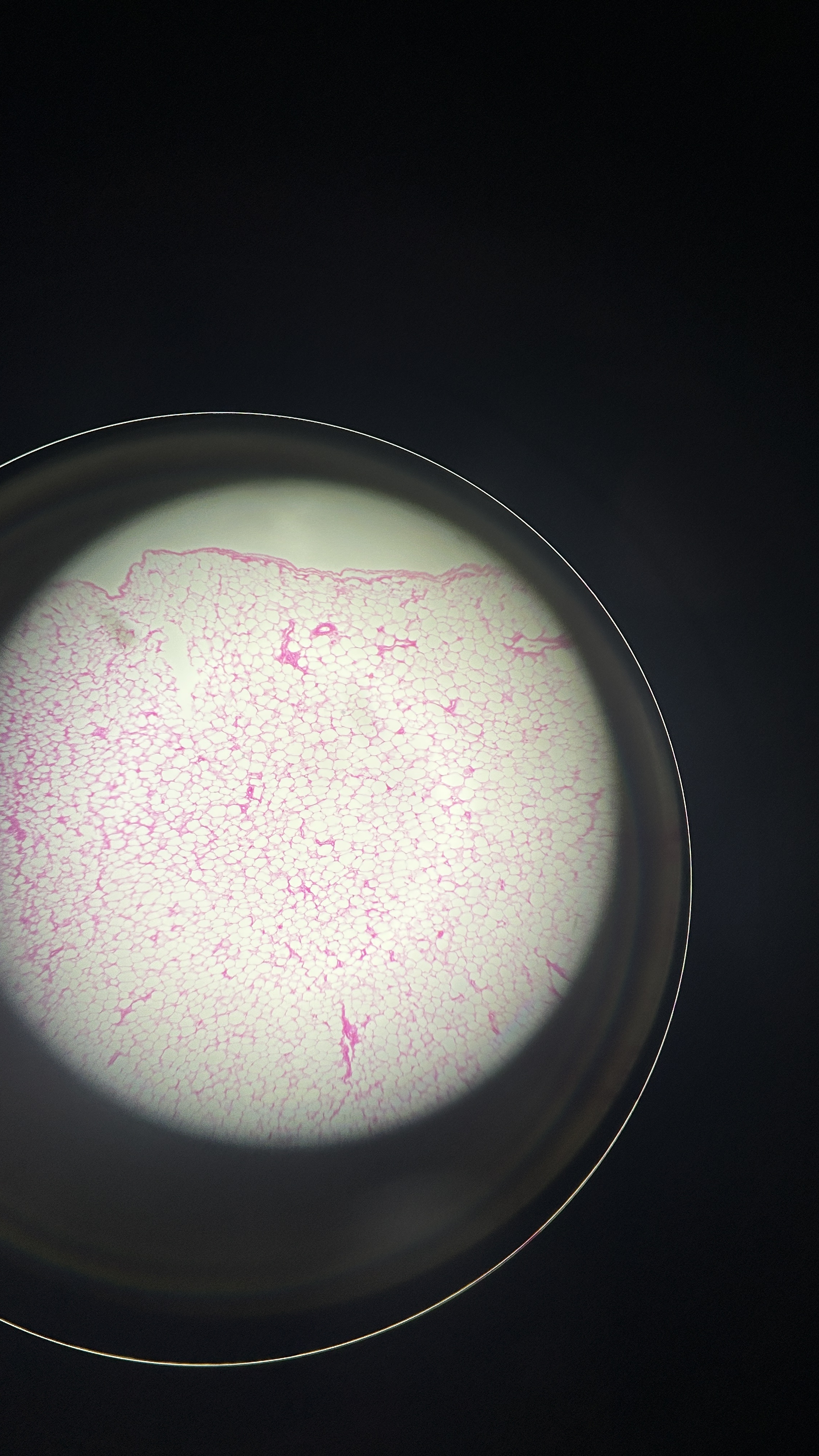 <p>What is the magnification level of the Adipose Tissue?</p>