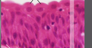 <ul><li><p><span style="background-color: transparent; font-family: "Book Antiqua", serif;"><span>If filled with urine, stretched so squamous-like</span></span></p></li><li><p><span style="background-color: transparent; font-family: "Book Antiqua", serif;"><span>If empty, cells appear columnar</span></span></p></li><li><p><span style="background-color: transparent; font-family: "Book Antiqua", serif;"><span>Found in ureter, urethra, bladder</span></span></p></li></ul><p></p>