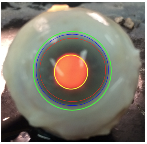 <p>Fascia Bulbi (Tenon’s capsule)— Green</p><p>Strongly adheres to episclera and conjunctiva</p>