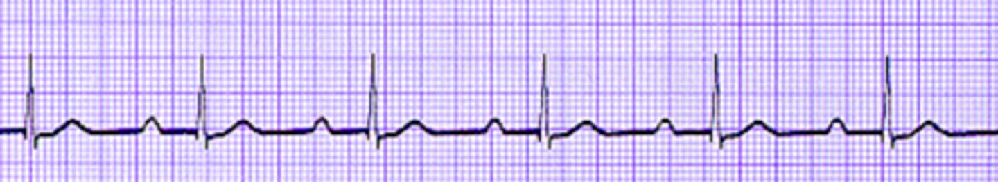 <p>Name the rhythm</p>