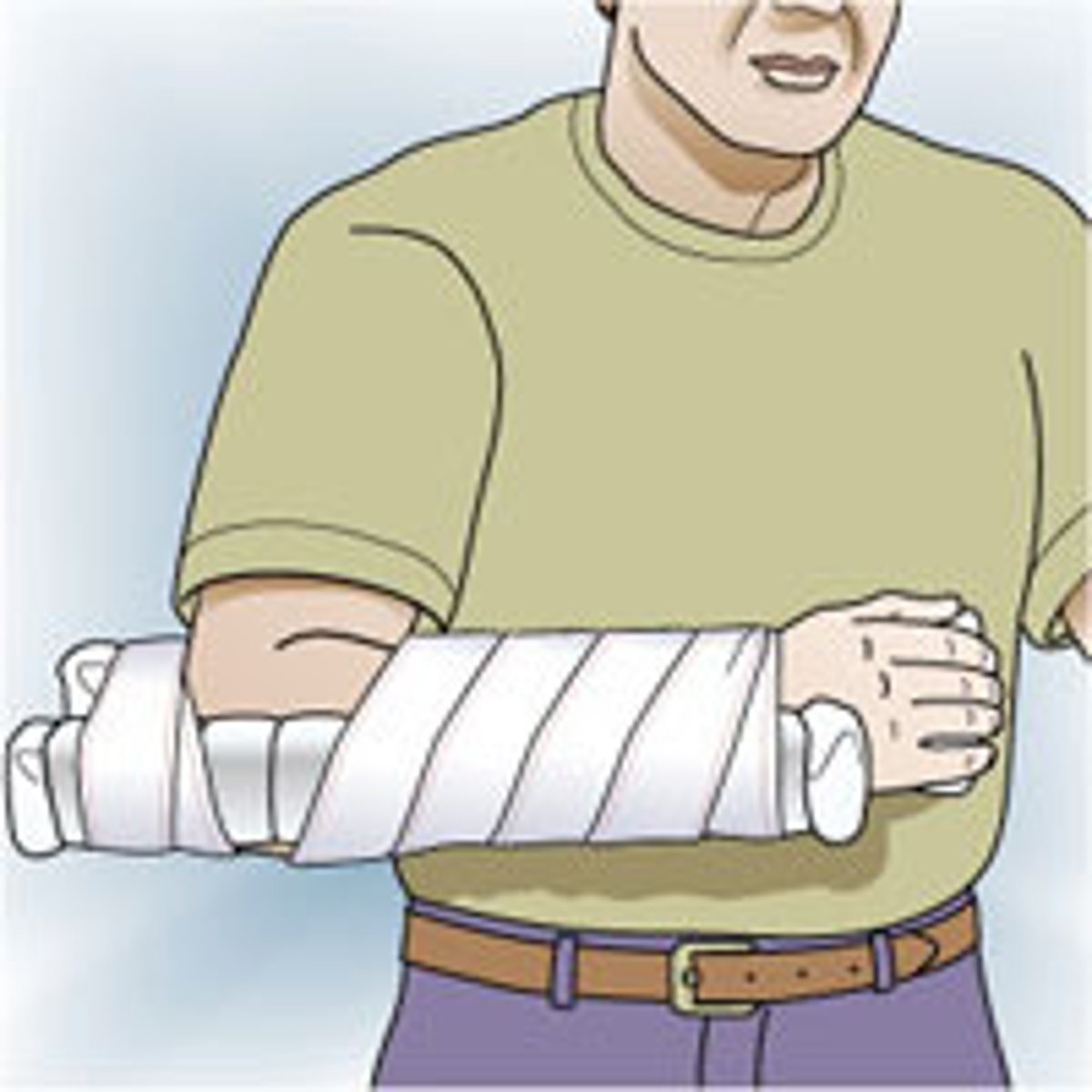 <p>1. Find materials to make splint (heavy cardboard, rolled newspapers)<br>2. hold splint close to injured area<br>3. place padding between splint and body<br>4. Use extra padding around body deformities, body hollows<br>5. Extend splint beyond joint above and below fracture<br>6. tie splint comfortably to body</p>