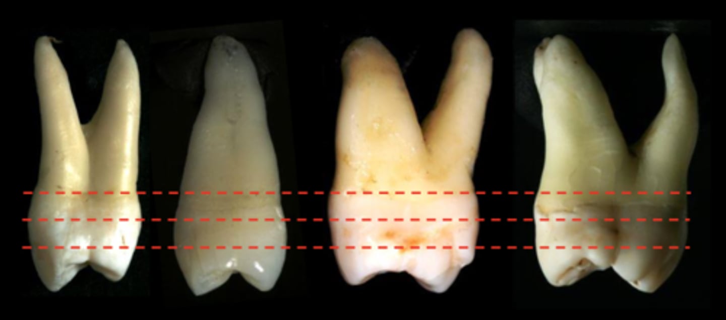 <p>The lingual HOC for maxillary posterior teeth is in the...</p>
