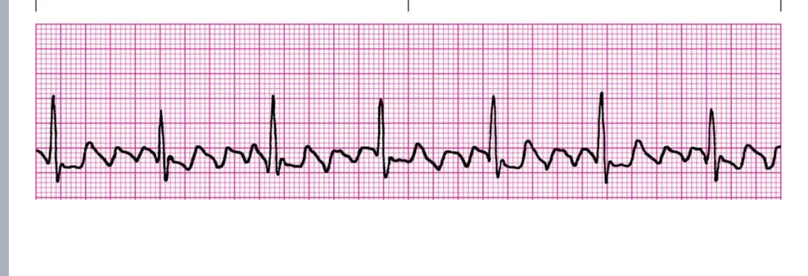 <p>How do you treat this</p>