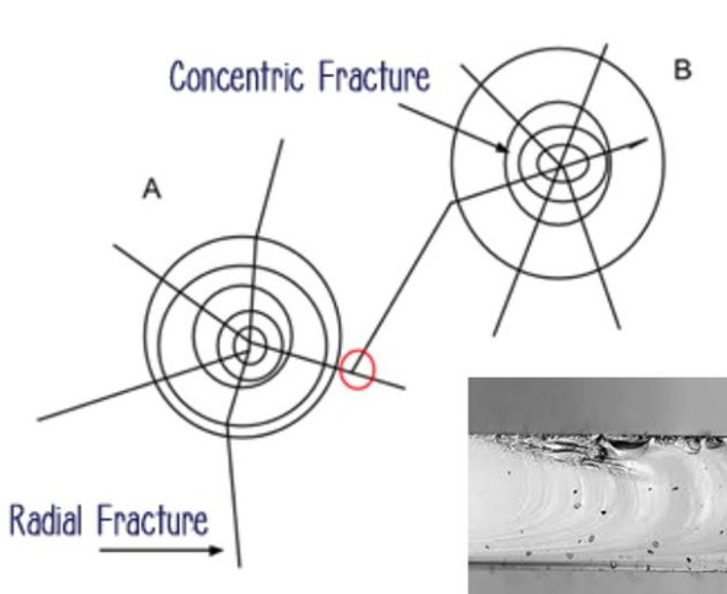 <p>Fractures that spread out from the impact point</p>