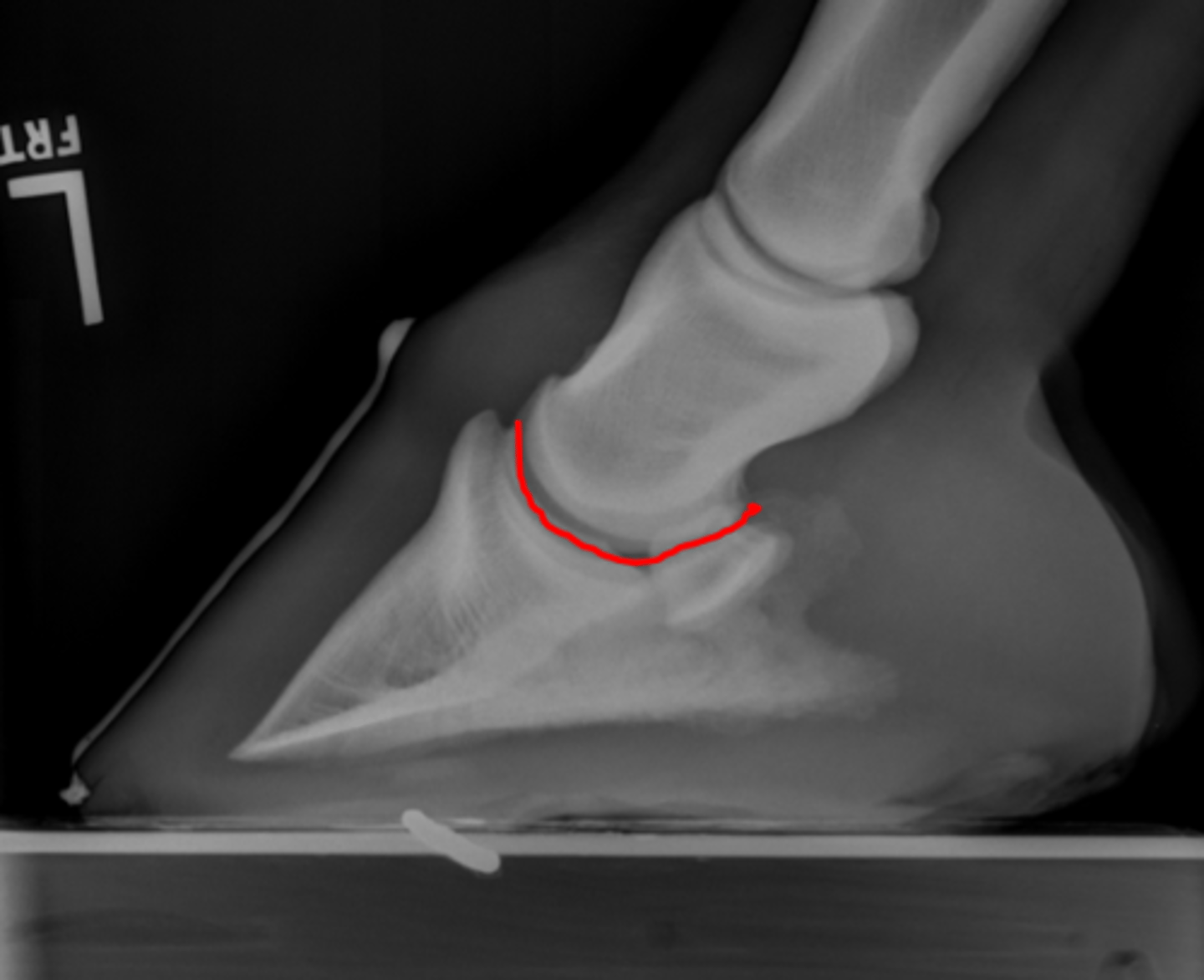 <p>coffin joint</p>
