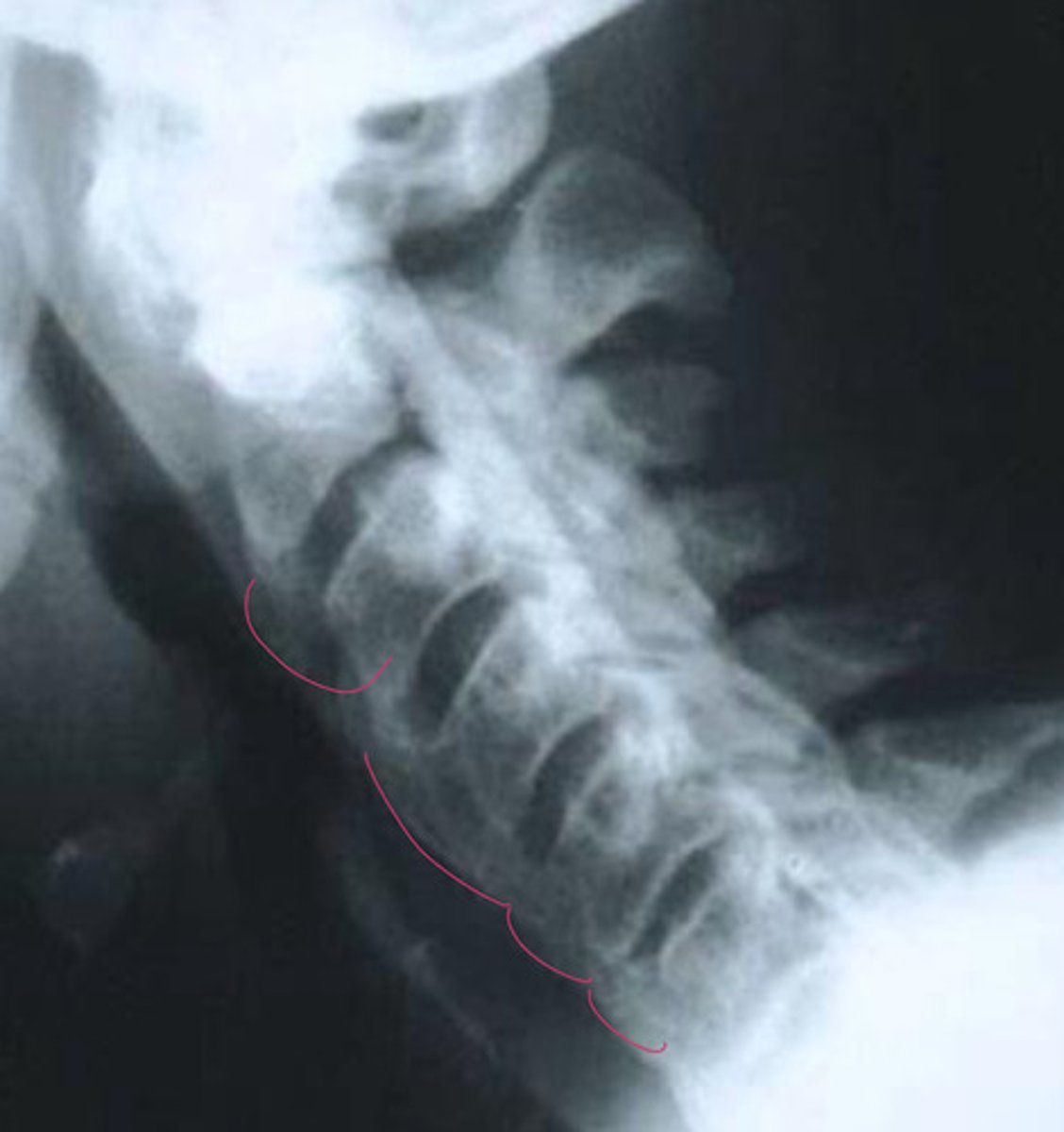 <p>What is this image showing?</p>