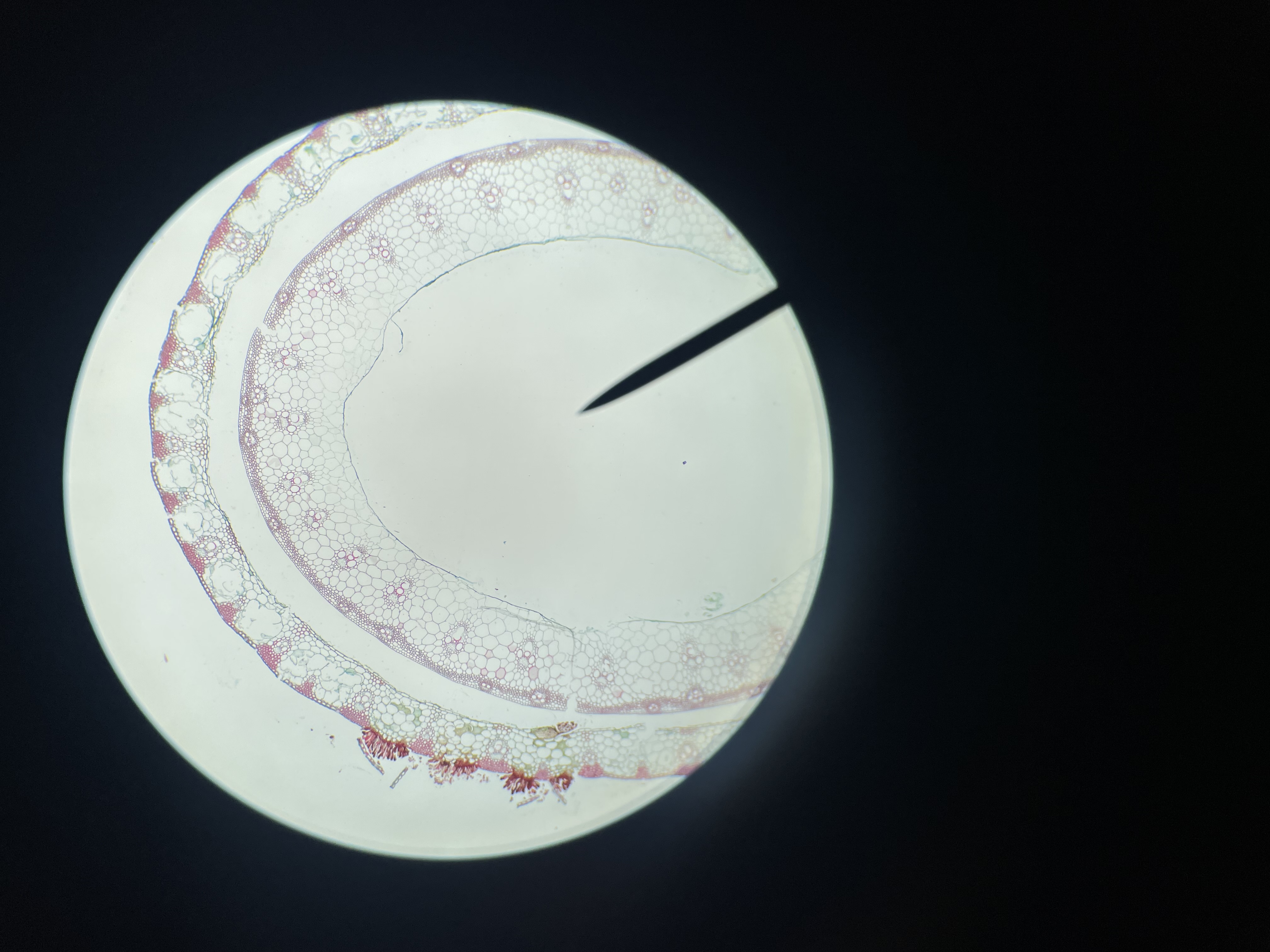 <p>Basidiomycota</p><p>Puccinia graminis</p>