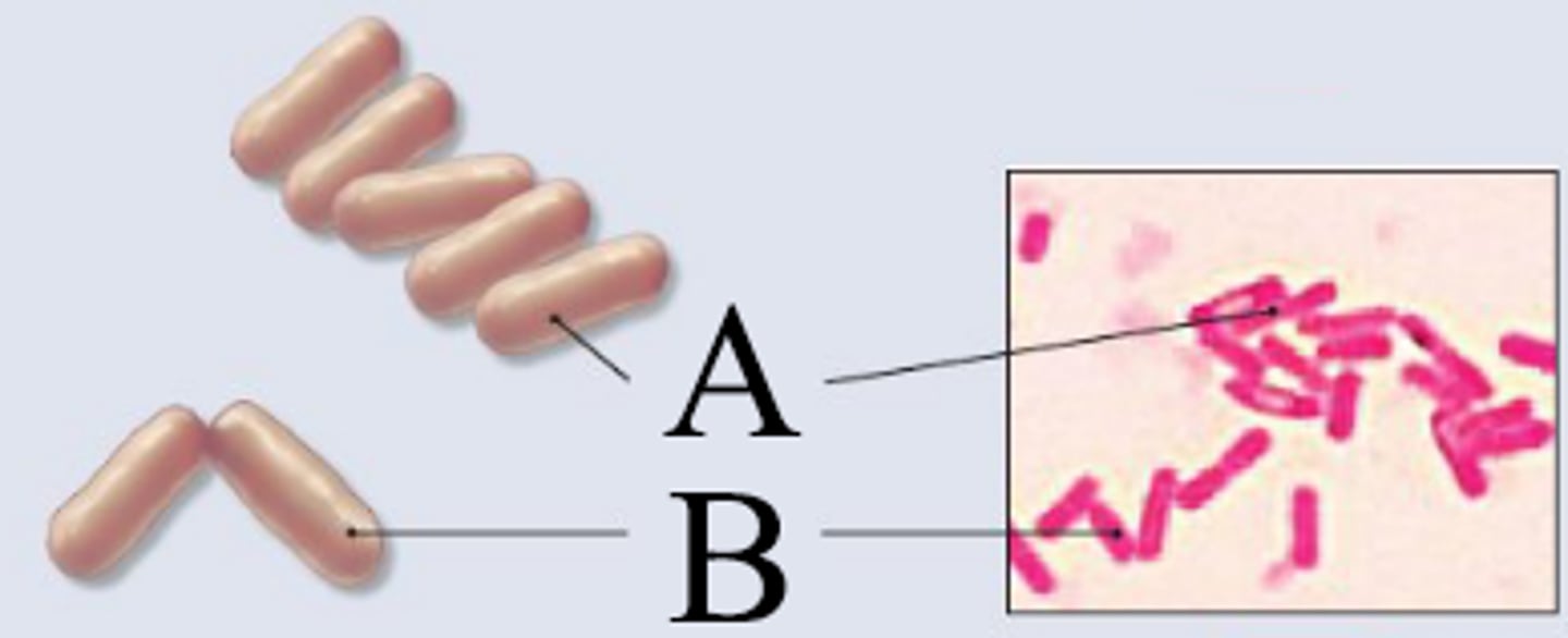 <p>bacilli that are arranged side by side, A</p>