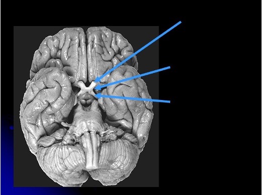 <p>what is the first arrow pointing to? </p>