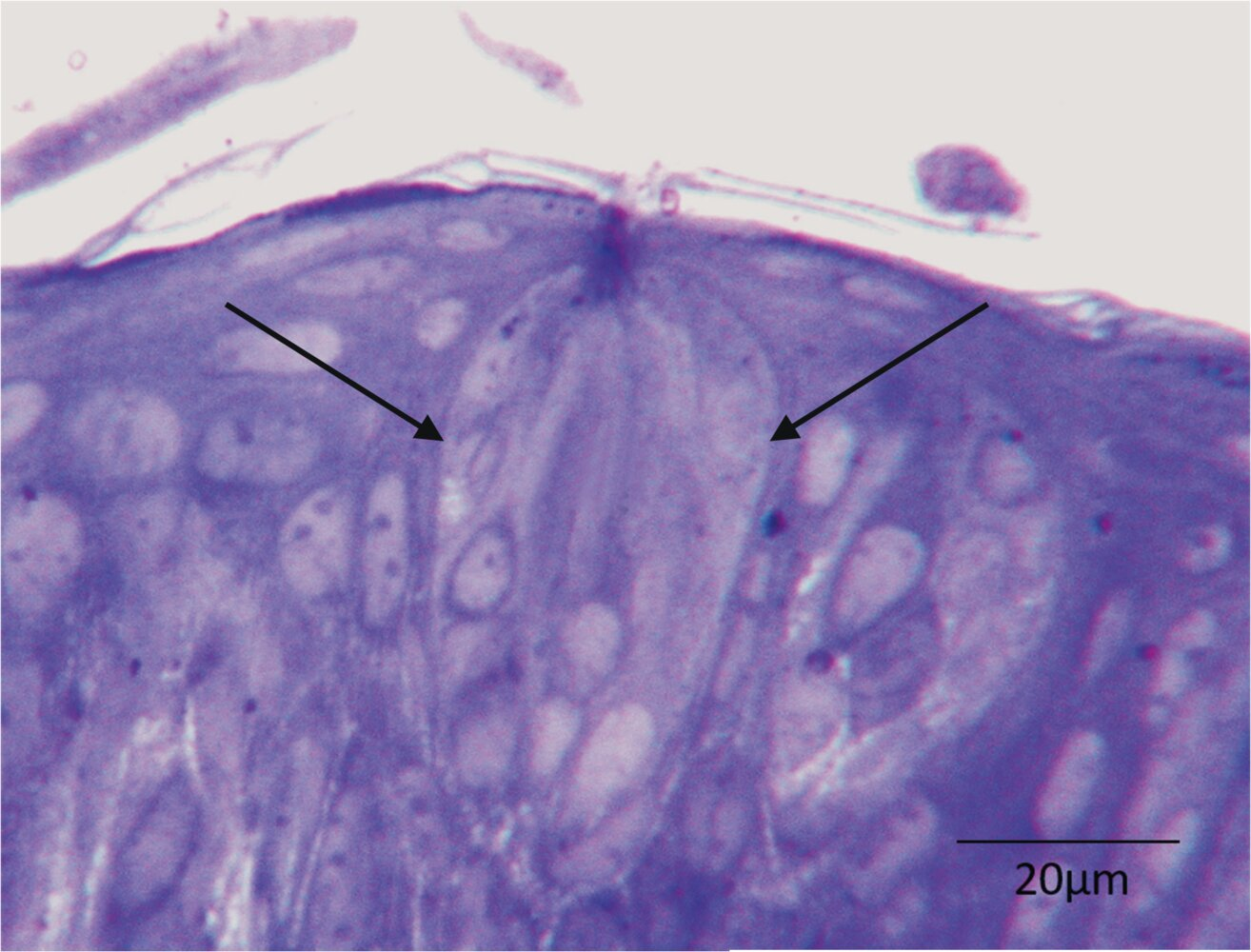 <p>68. Sensory stimuli are detected by various specialized receptors.</p><p>Which sensory stimuli are detected by the structure marked with two arrows in the illustration?</p><p>A. Acoustic stimuli</p><p>B. Taste stimuli</p><p>C. Cold stimuli</p><p>D. Pain stimuli</p><p>E. Vibration stimuli</p>