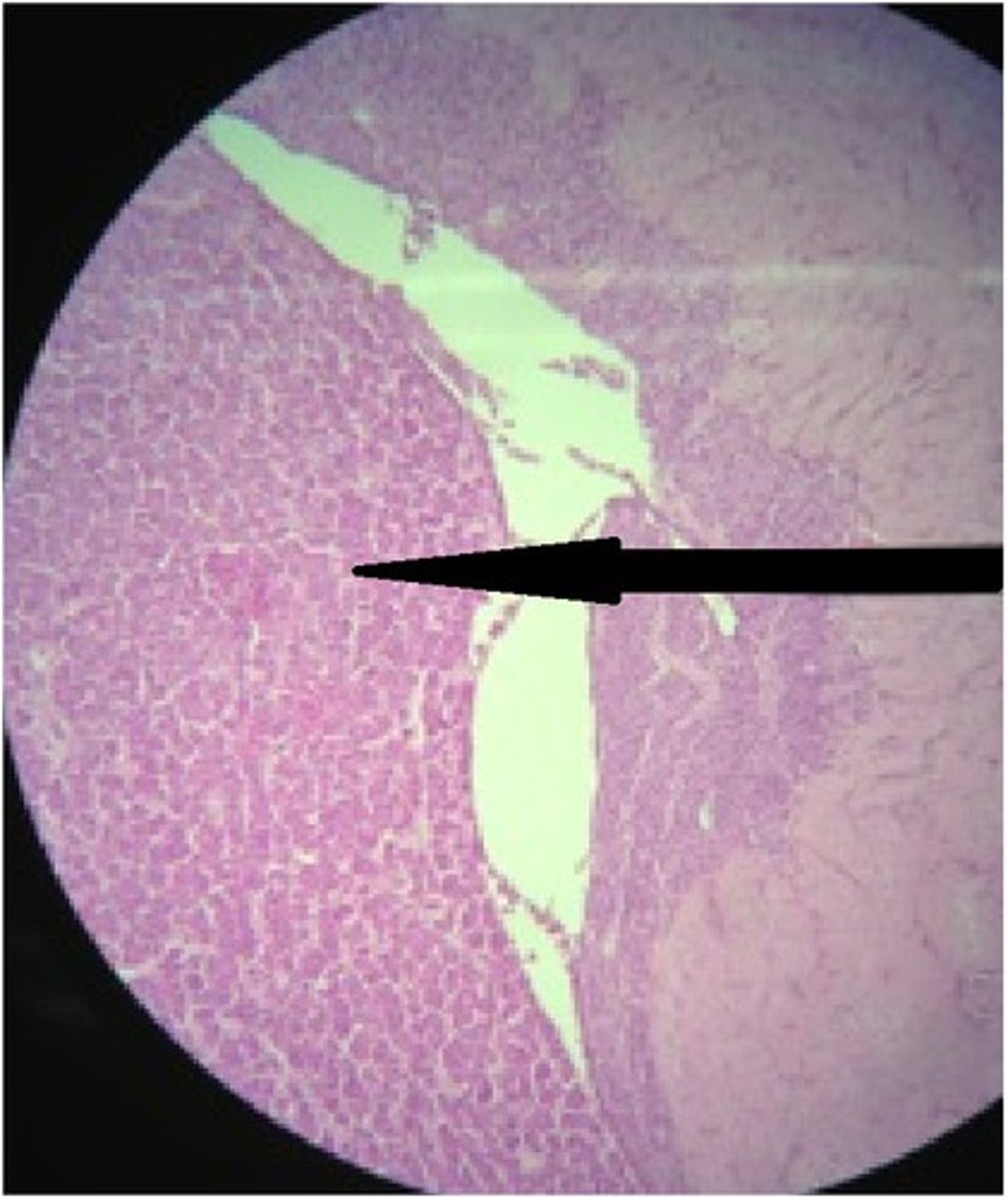 <p>A. Label B. Hormones made there</p>