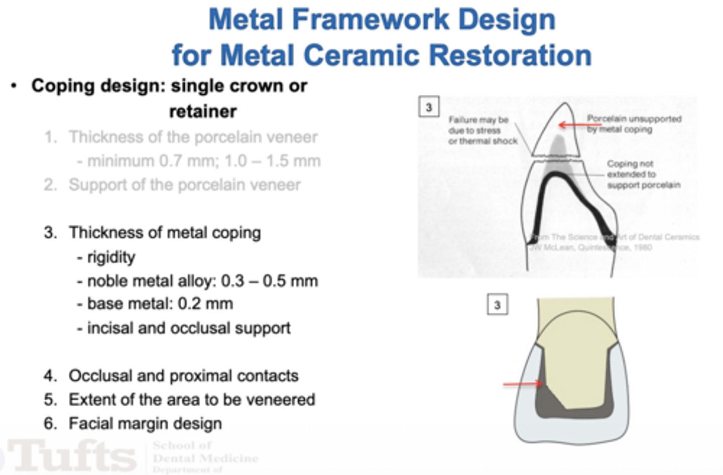 <p>Metal coping</p>