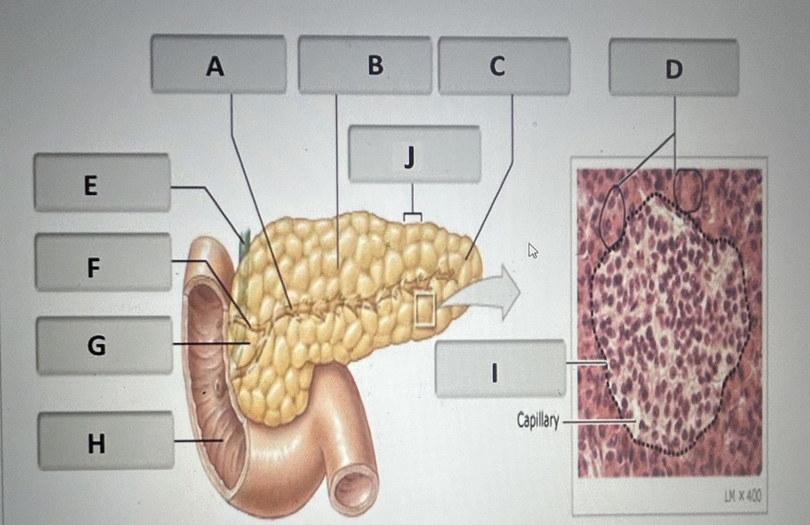 Identify the pancreatic structure labeled I 