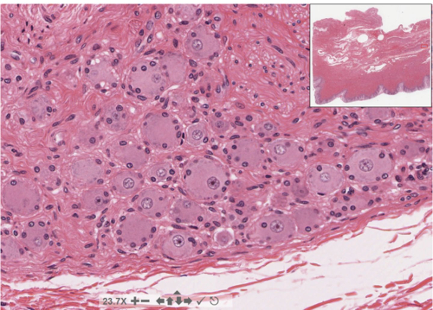 <p>Identify the organ of the PNS</p>