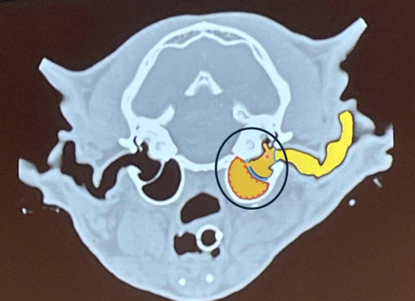 <p>What is circled?</p>