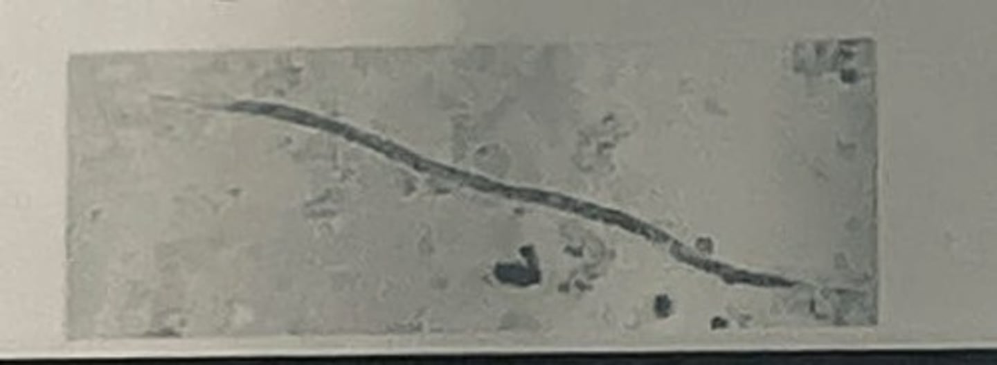 <p>They are embryonic stage larvae and must develop in mosquitoes before they are infective to canine hosts.</p><p>3 multiple choice options</p>