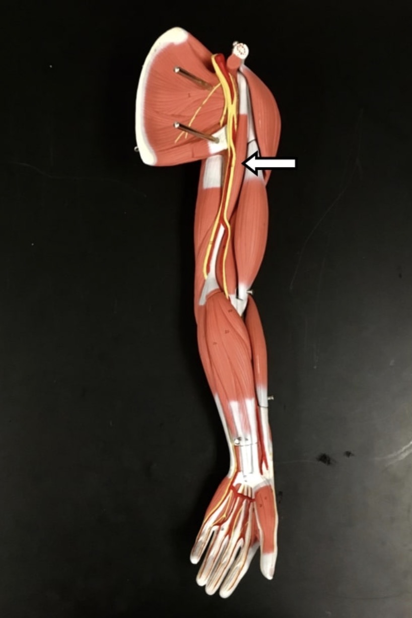 <p><span>Name the muscle labeled with the white arrow below.</span></p>