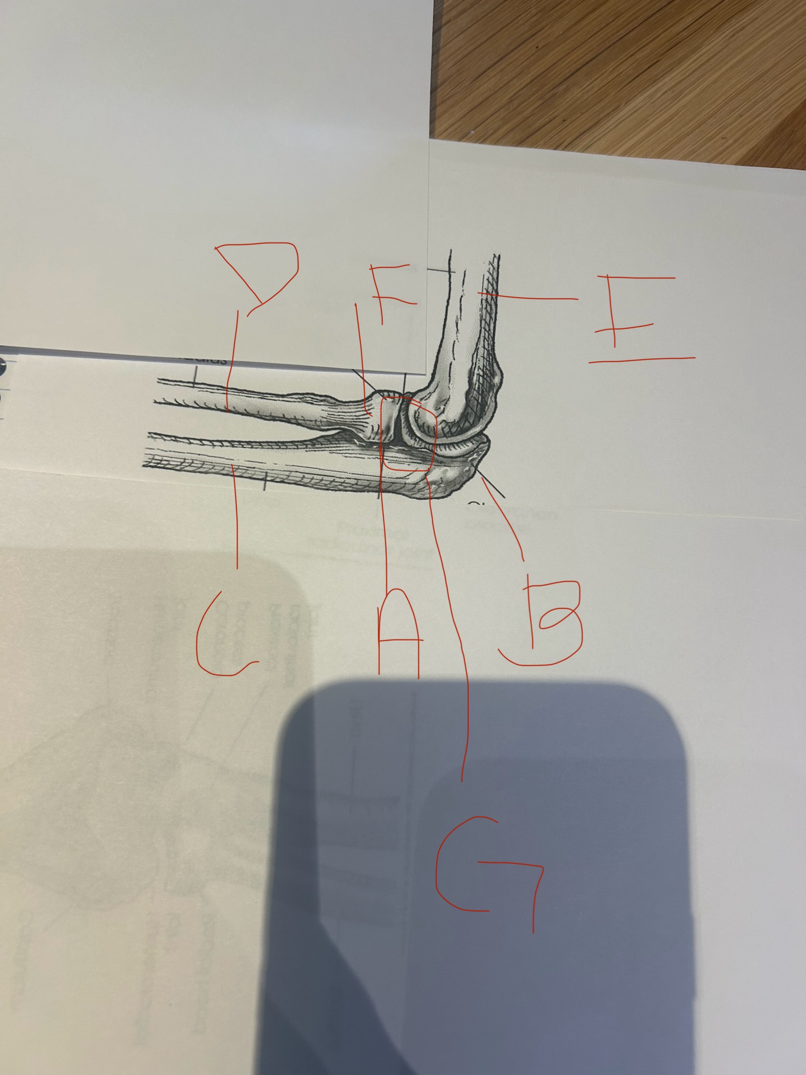 <p>label this image</p>