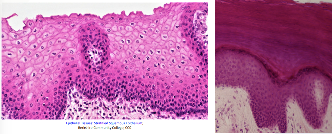 <ul><li><p>Multiple layers of flattened cells → to protect lots of its cells</p><ul><li><p>Deeper layers may be cuboidal or columnar</p></li></ul></li><li><p>Location: Makes up the epidermis of the skin, lines oral cavity, esophagus, and vagina</p></li></ul>