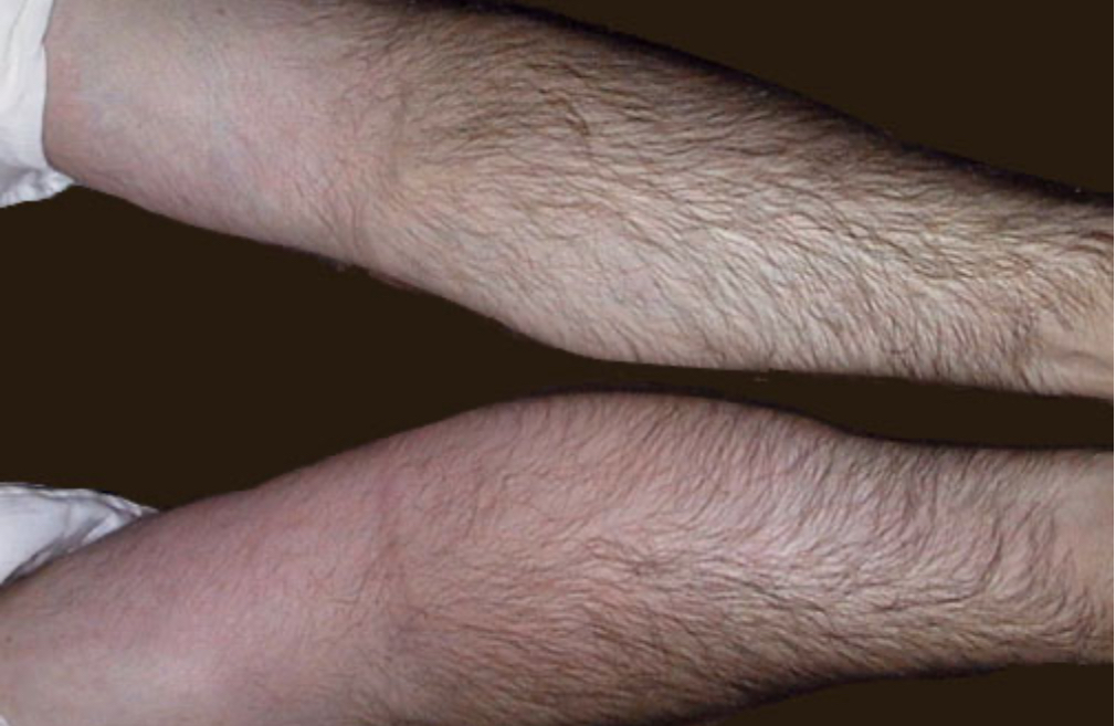 <ol><li><p>Where would be the most painful when touched?</p></li><li><p>Describe the arm at the bottom</p></li></ol>