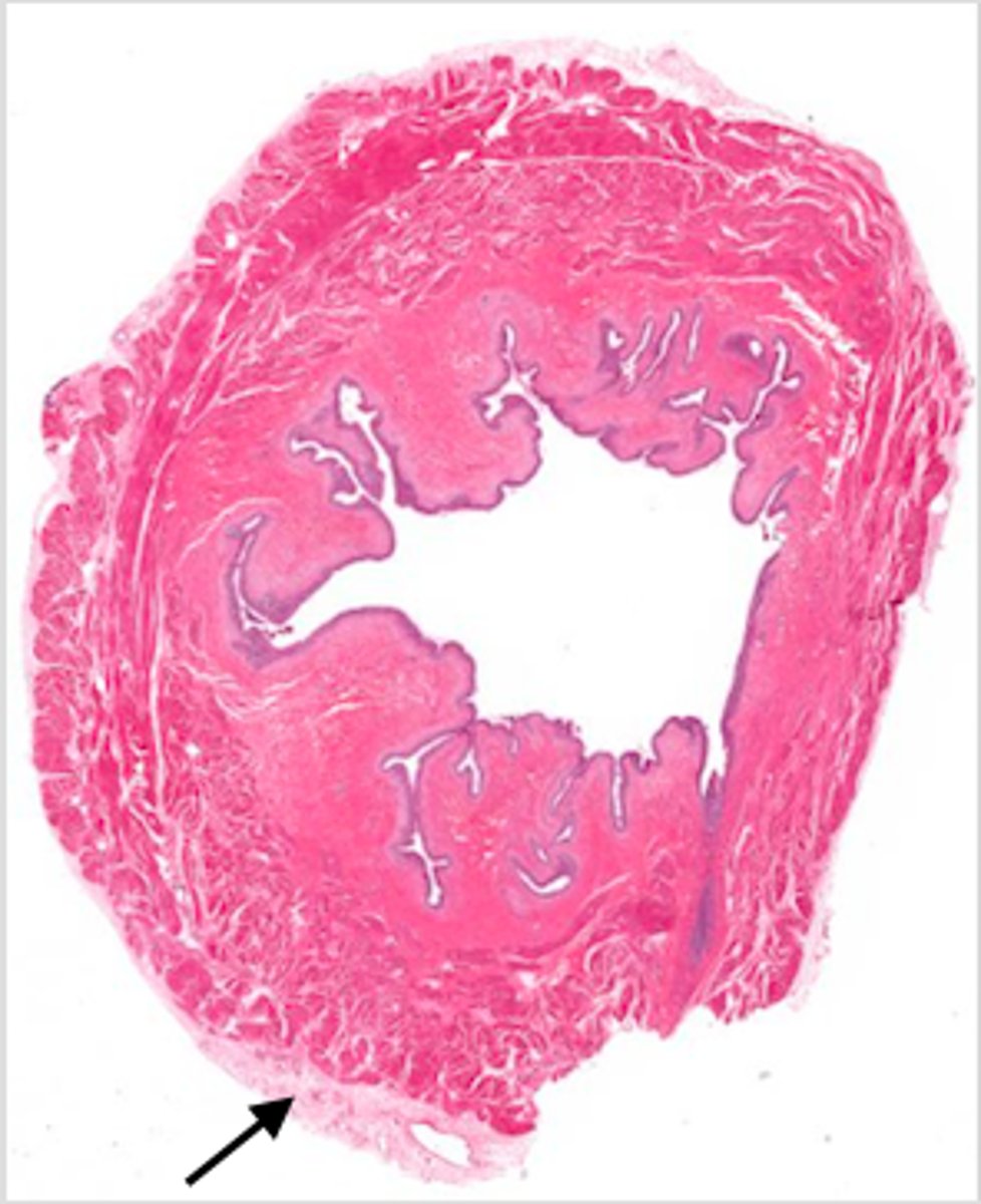 <p>Everywhere that is NOT the superior portion of the bladder</p>