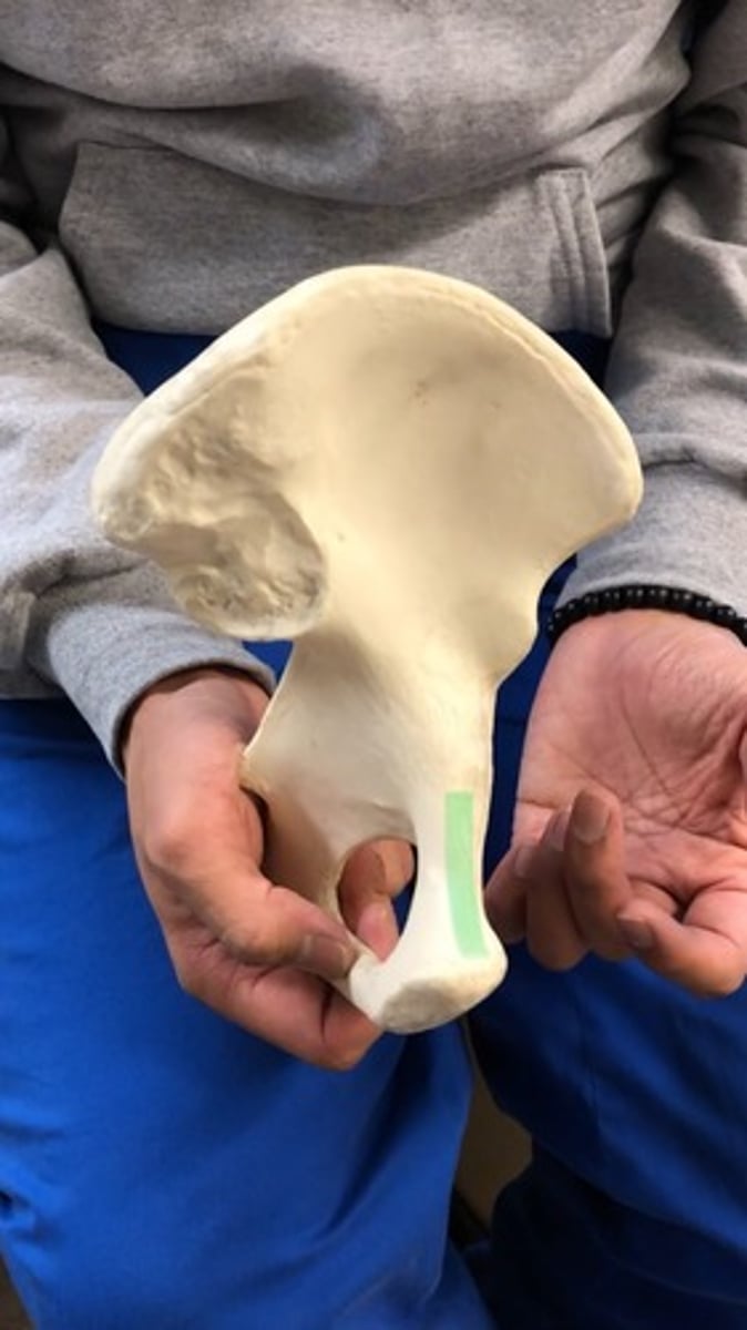 <p>other half of ridge; goes up to the arcuate line in ilium</p>
