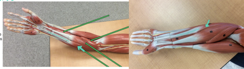 <p>Identify this muscle?</p>