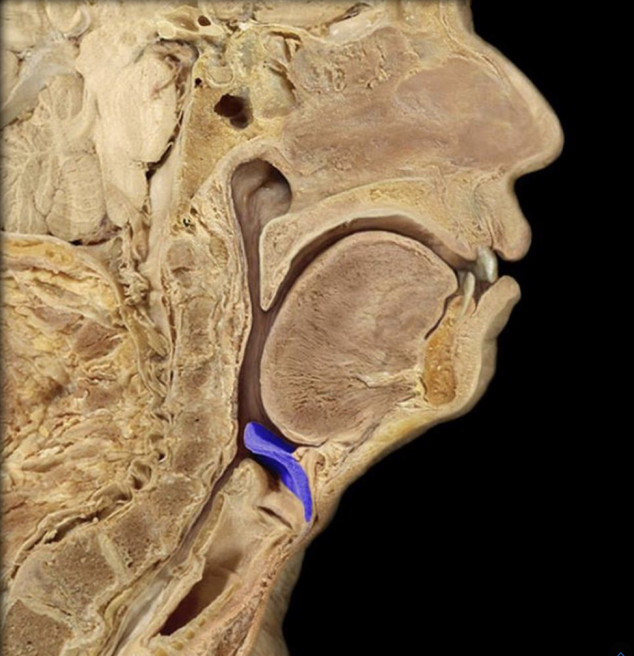 What structure is highlighted in blue?