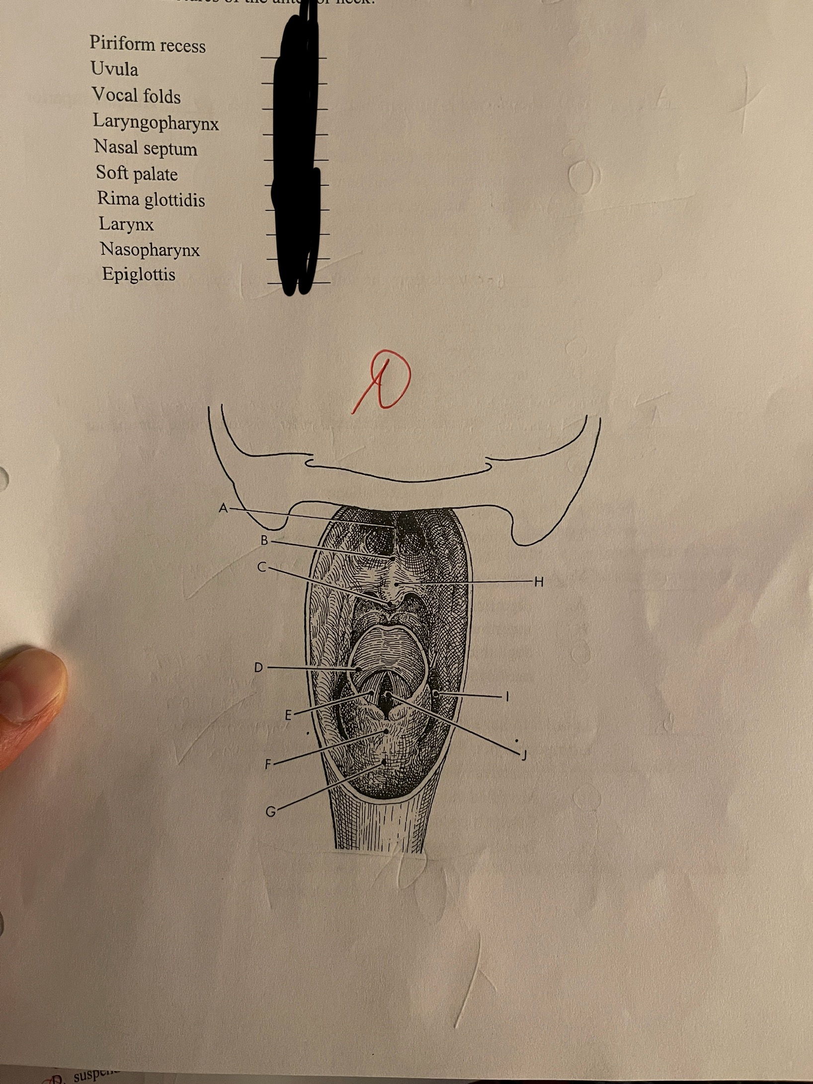 <p>Match the following anatomy to its correct location on this posterior view of the soft tissue structures of the anterior neck</p>