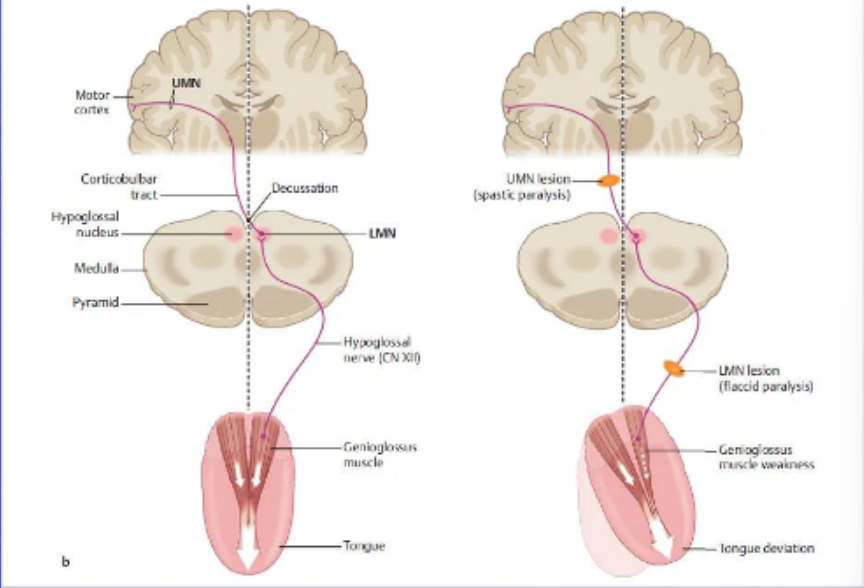 <p>What are upper motor neurons (UMNs)?</p>