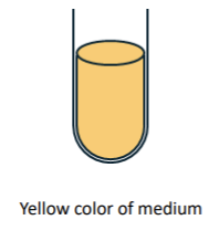 <p>what is this result in methyl red test?</p>