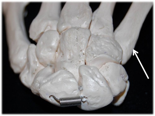 Name this specific bone of the hand (posterior view).