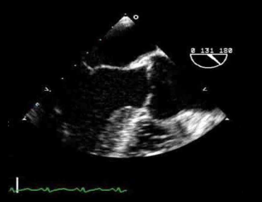 <p>Identify the view and structures</p>