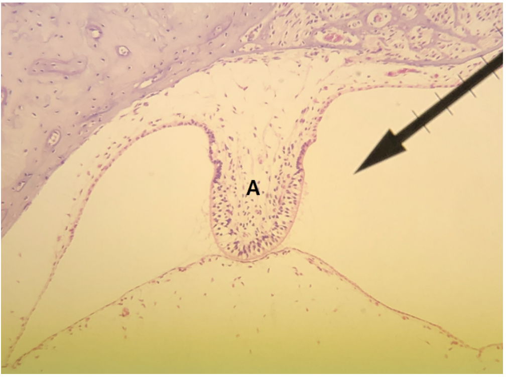 <p><span><span>In the image above, identify structure A.</span></span></p>