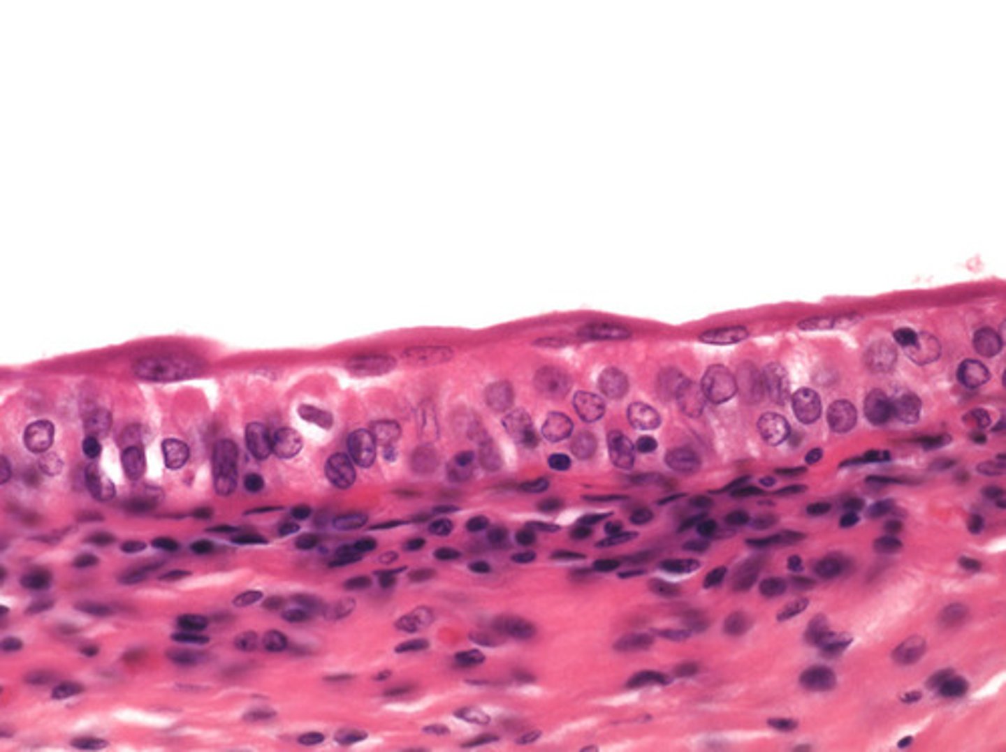 <p>lines the bladder, urethra, and the ureters</p>